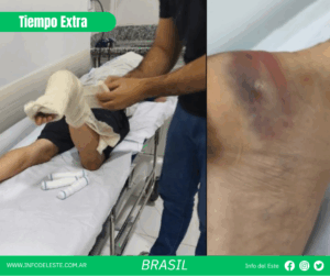 Tiempo Extra: Brutal represión policial a hinchas del tomba en Brasil